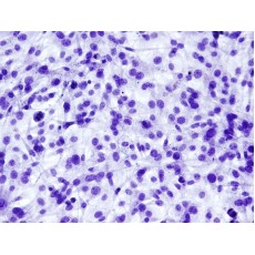 Mouse Preadipocytes -white fat (MPAd-wf)